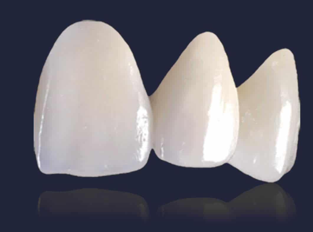 Dentus perfectus - zircon ceramics