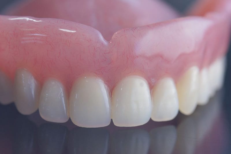 Dentus perfectus - prosthetics - dentures